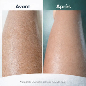 ReliefVital – Guanto esfoliante per schiena e corpo